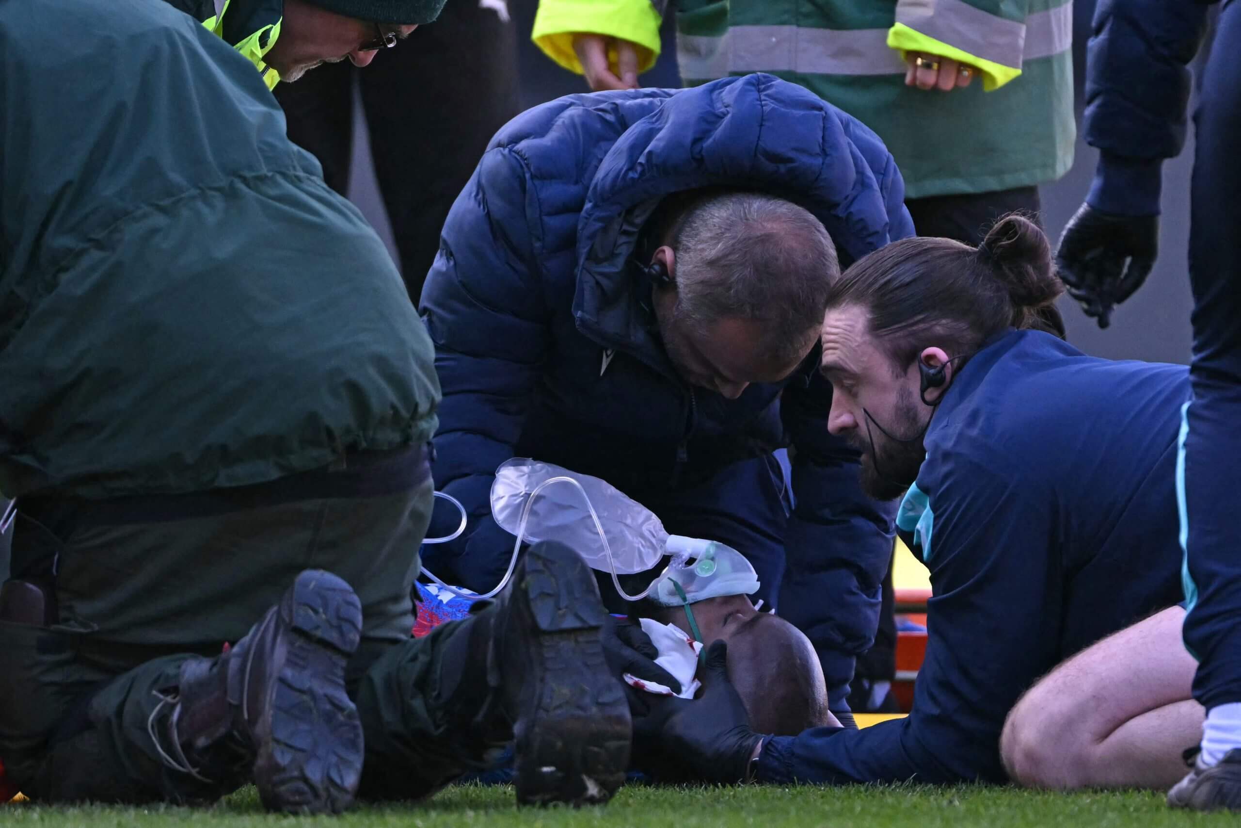 Mateta received oxygen from medics following the challenge (GLYN KIRK/AFP via Getty Images)